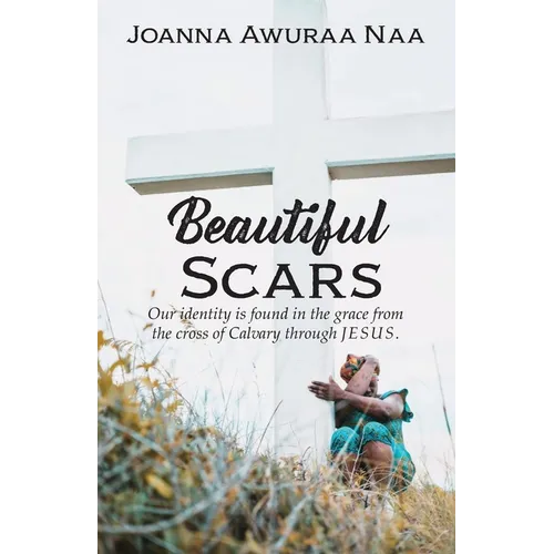Beautiful Scars: Our Identity is Found in the Grace from the Cross of Calvary through Jesus