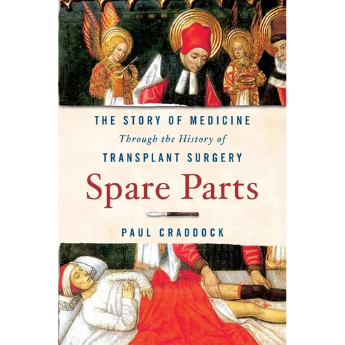 Spare Parts: The Story of Medicine Through the History of Transplant Surgery