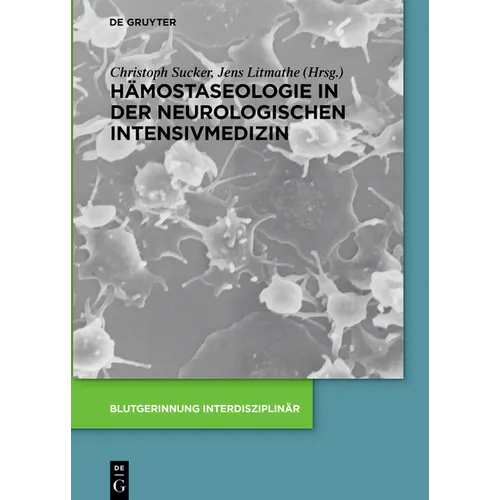 Hämostaseologie in der neurologischen Intensivmedizin