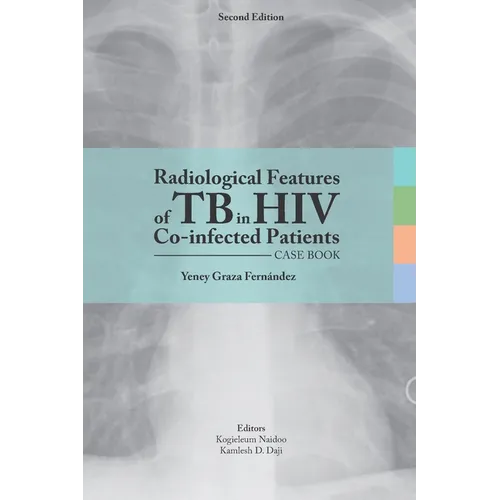 Radiological features of TB in HIV Co-infected Patients. Case book