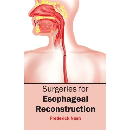 Surgeries for Esophageal Reconstruction