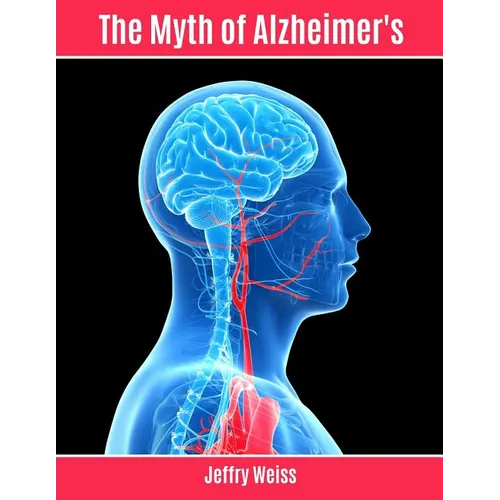 The Myth of Alzheimer's