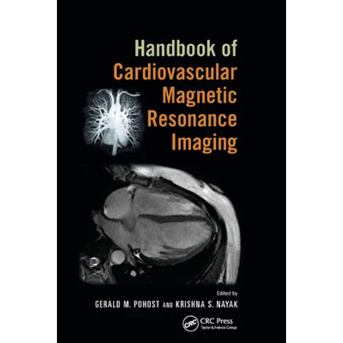 Handbook of Cardiovascular Magnetic Resonance Imaging