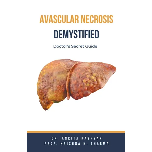 Avascular Necrosis Demystified: Doctor's Secret Guide