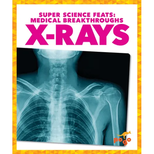 X-Rays