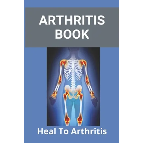 Arthritis Book: Heal To Arthritis: Rheumatoid Arthritis Treatment