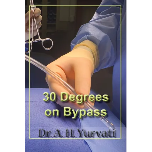 30 Degrees on Bypass