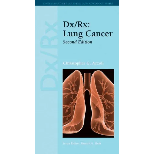 DX/Rx: Lung Cancer: Lung Cancer